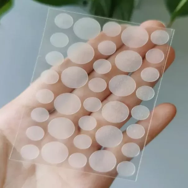 Paistí acne